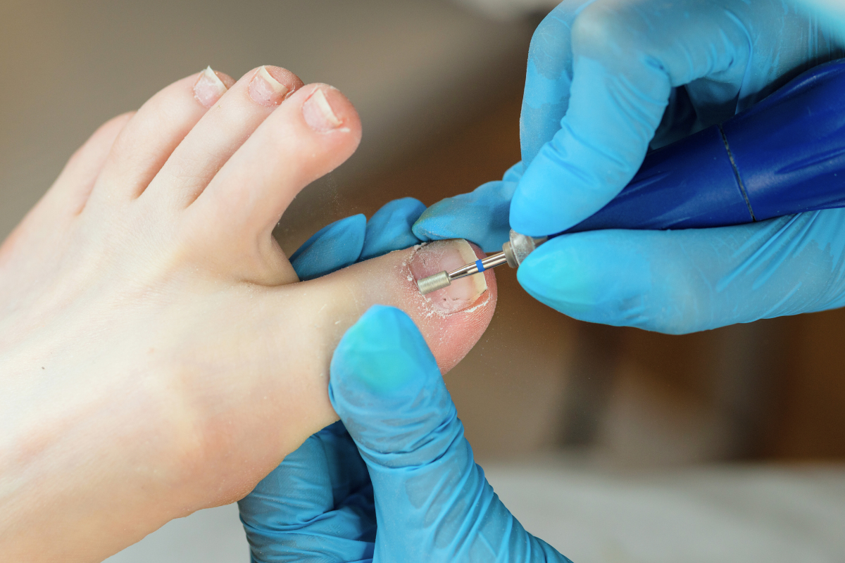 ¿Es un Simple Dolor de Pies? 5 Señales de que Necesitas un Podólogo en Panamá